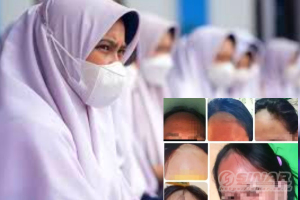 Hanya dikarenakan tidak menggunakn ciput / penahan rambut agar tidak keluar dari jilbab, 19 siswi SMPN 1 Sukodadi, Lamongan, Jawa Timur, digunduli pada Selasa, 23 Agustus 2023.